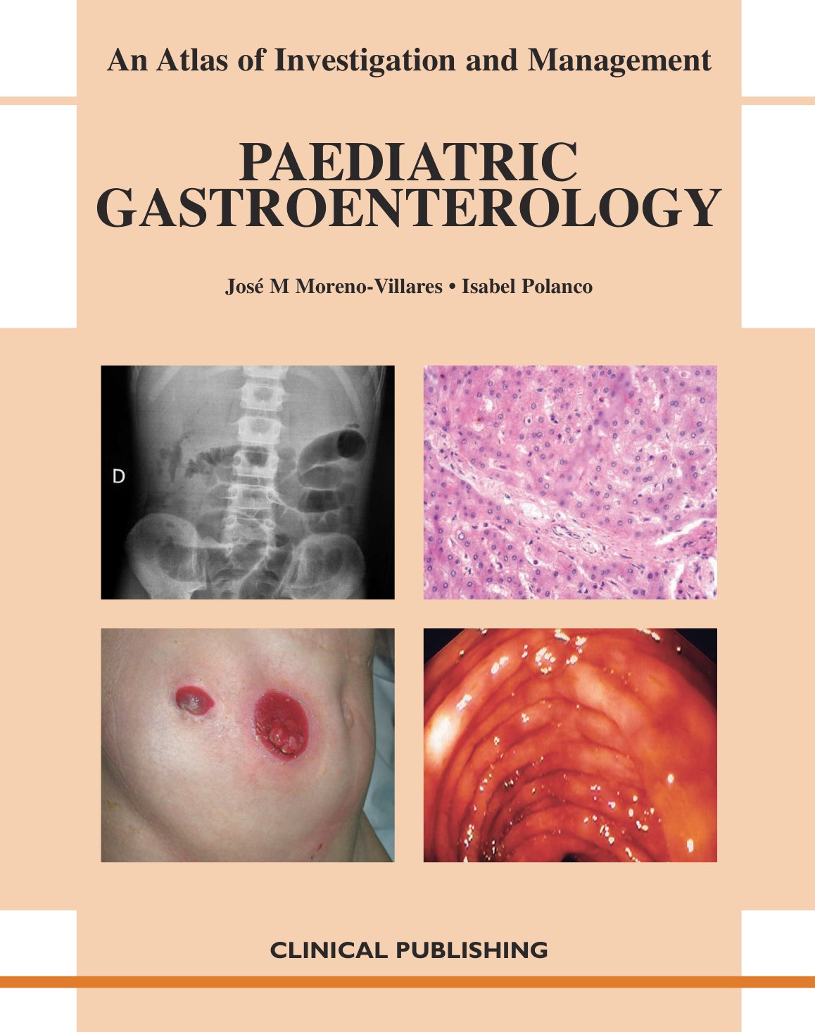 Cover of Paediatric Gastroenterology (2009)
