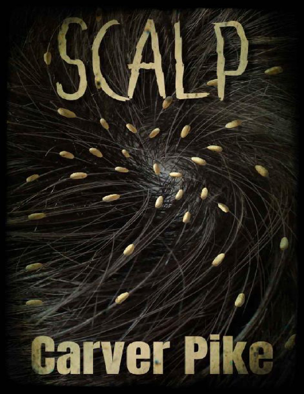 Cover of Scalp